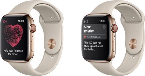 纽约医生告苹果 Watch 侵权，称「监测不规则脉搏律动」侵犯专利
